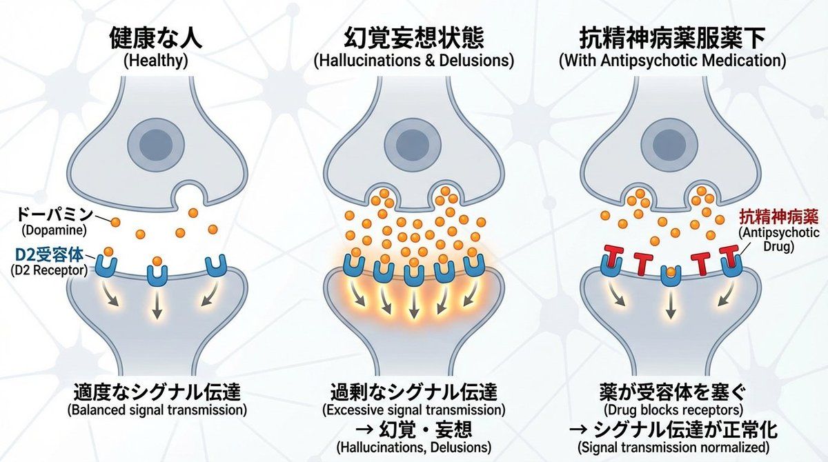 多巴胺与精神分裂症突触图